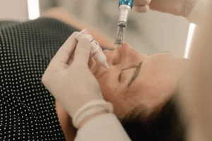 microneedling_e0265cd0-f8c5-4997-b636-09b72e09a977_1024x1024